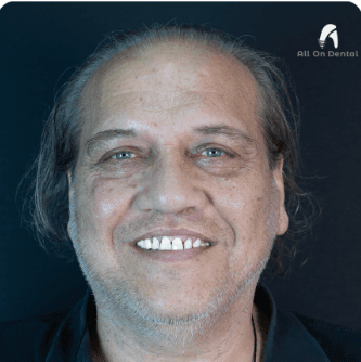 MD – DDS Ahmet Sinan Cem Çepeloğlu